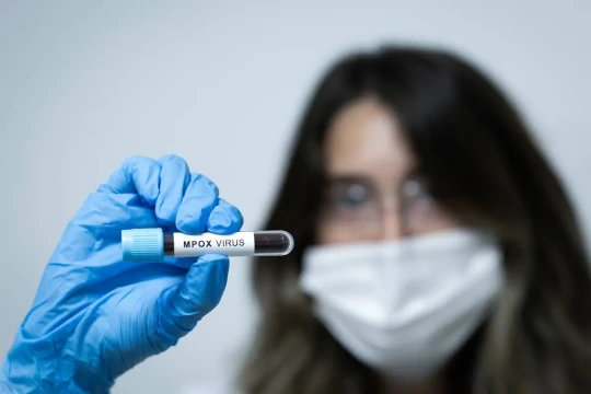 Jordan confirms first mpox case-Jordan