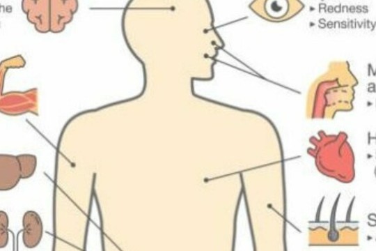 W. Equatoria State receives Yellow Fever vaccines-Sudan