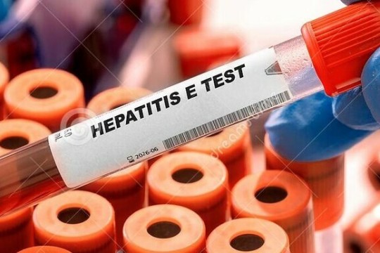 Hepatitis E outbreak reported in Twic County-Sudan