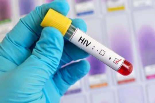 Bor health worker reveals surge in HIV-positive pregnant women-Sudan