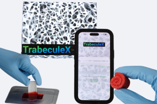 Xenco Medical Unveils the TrabeculeX Continuum, a Breakthrough Convergence of Digital Health and Biomaterials, at CES 2024 in Las Vegas, the World’s Largest Technology Conference