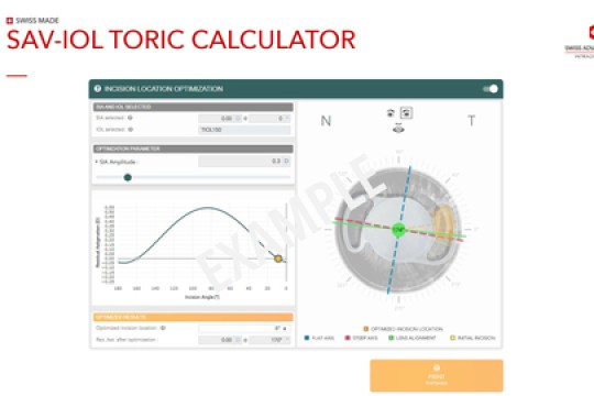 New Swiss Made Features for Cataract Surgery Lens Selection