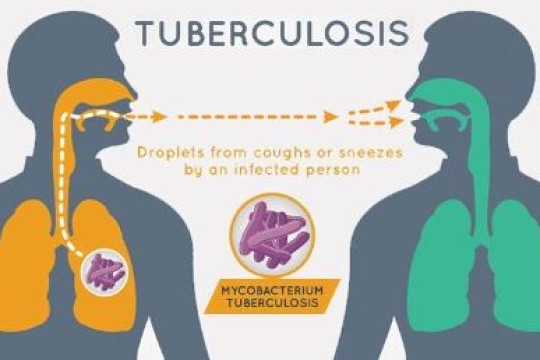 Pochalla TB patients seek testing, treatment in Ethiopia-Sudan