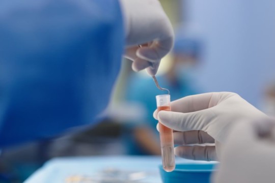 Abu Dhabi Stem Cells Centre pioneers testicular cryopreservation for four boys before bone marrow transplants-UAE